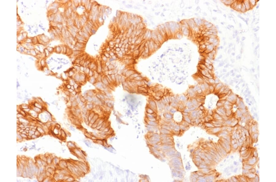 Immunohistochemistry - Anti-EpCAM Antibody [EGP40/1798] (A249249) - Antibodies.com