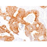 Immunohistochemistry - Anti-EpCAM Antibody [EGP40/1798] (A249249) - Antibodies.com