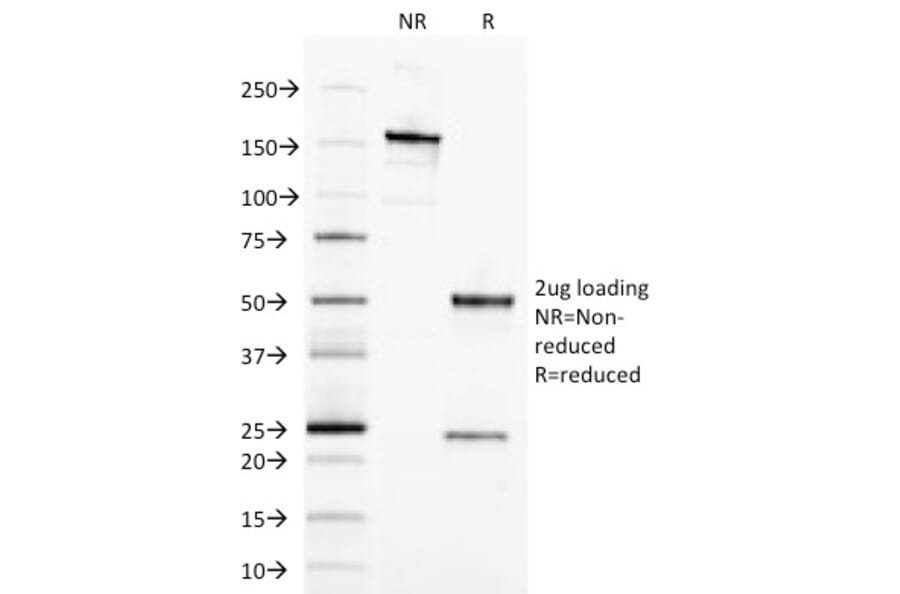 SDS-PAGE - Anti-EpCAM Antibody [EGP40/1798] (A249249) - Antibodies.com