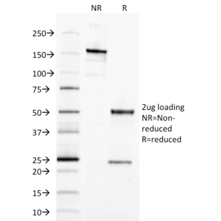 SDS-PAGE - Anti-EpCAM Antibody [EGP40/1798] (A249249) - Antibodies.com