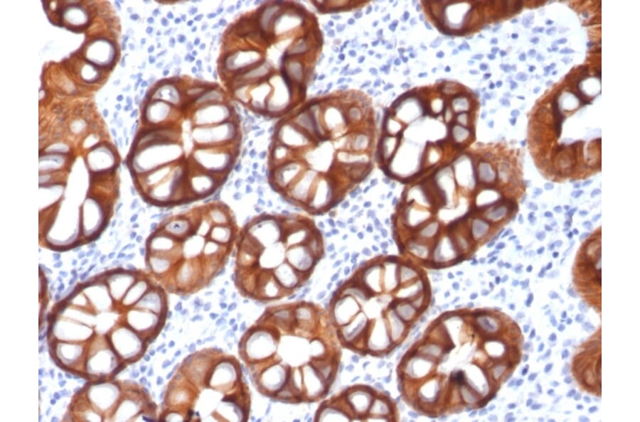 Immunohistochemistry - Anti-EpCAM Antibody [rMOC-31] (A249250) - Antibodies.com