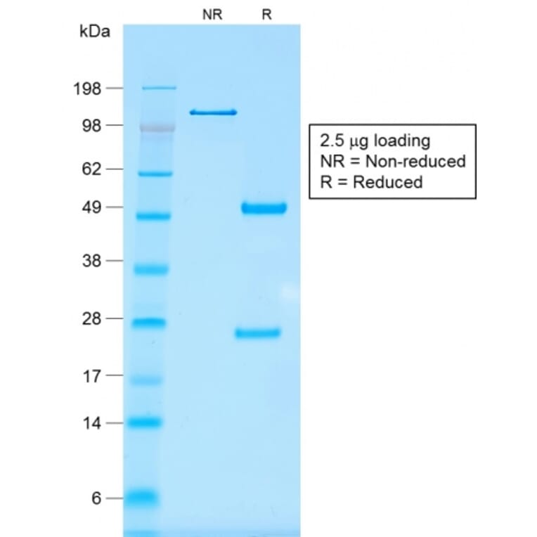 SDS-PAGE - Anti-EpCAM Antibody [rMOC-31] (A249250) - Antibodies.com