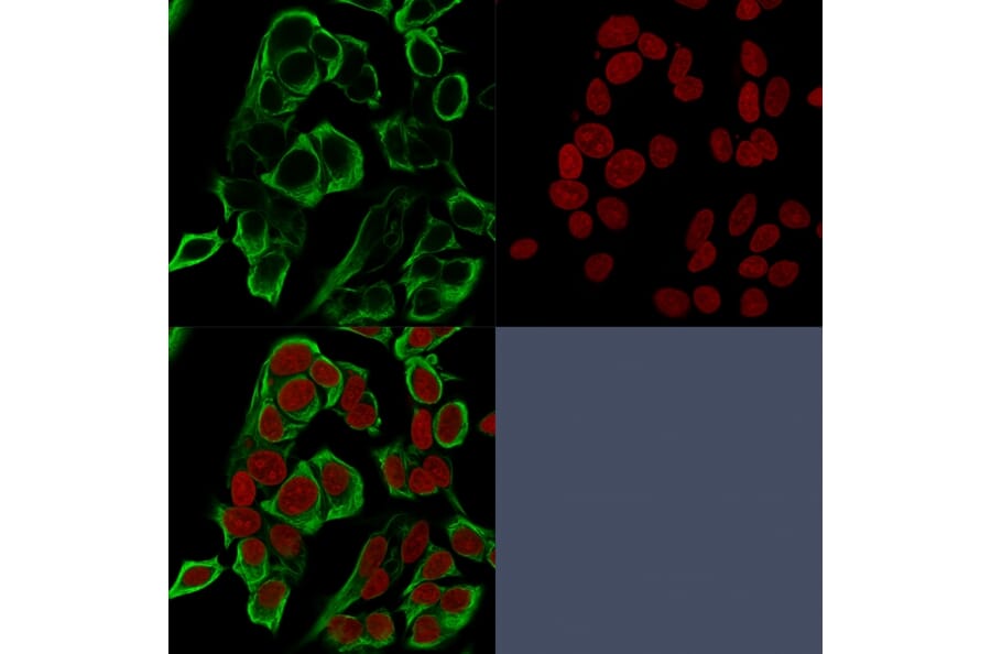 Immunofluorescence - Anti-EpCAM Antibody [rMOC-31] (A249249) - Antibodies.com