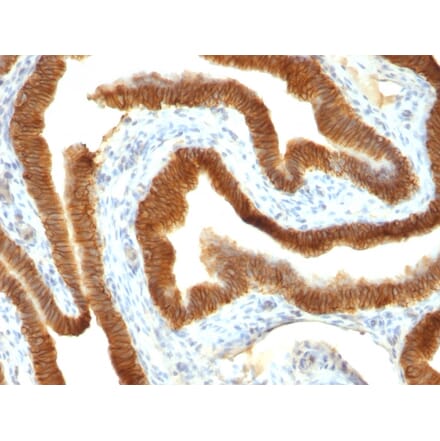 Immunohistochemistry - Anti-EpCAM Antibody [VU-1D9] (A249251) - Antibodies.com
