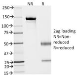 SDS-PAGE - Anti-EpCAM Antibody [VU-1D9] (A249251) - Antibodies.com