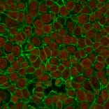 Immunofluorescence - Anti-EpCAM Antibody [VU-1D9] (A249251) - Antibodies.com