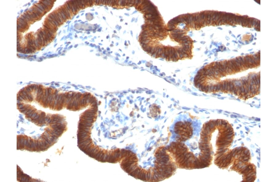 Immunohistochemistry - Anti-EpCAM Antibody [SPM134] (A249252) - Antibodies.com