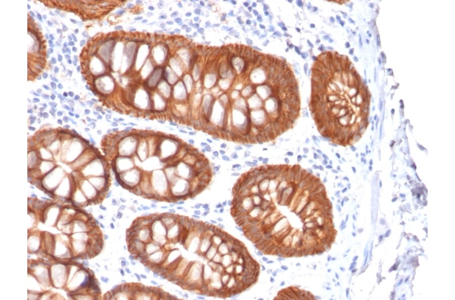 Immunohistochemistry - Anti-EpCAM Antibody [rVU-1D9] (A252430) - Antibodies.com