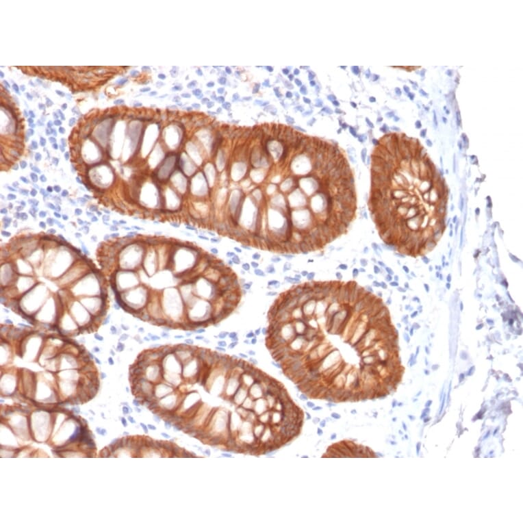 Immunohistochemistry - Anti-EpCAM Antibody [rVU-1D9] (A252430) - Antibodies.com