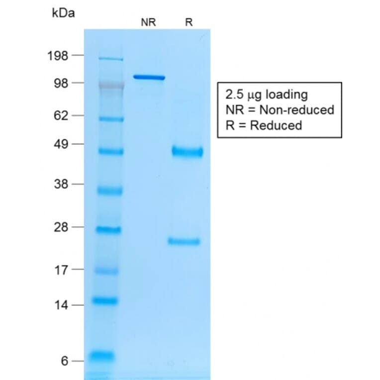 SDS-PAGE - Anti-EpCAM Antibody [rVU-1D9] (A252430) - Antibodies.com