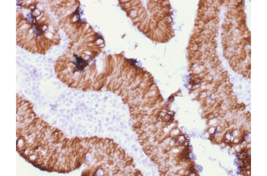 Immunohistochemistry - Anti-EpCAM Antibody [rEGP40/1372] (A249254) - Antibodies.com