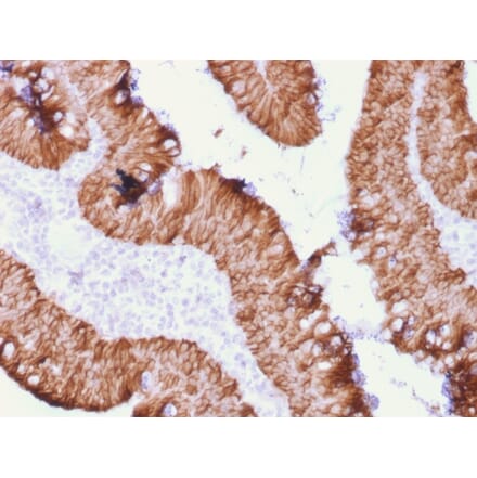 Immunohistochemistry - Anti-EpCAM Antibody [rEGP40/1372] (A249254) - Antibodies.com