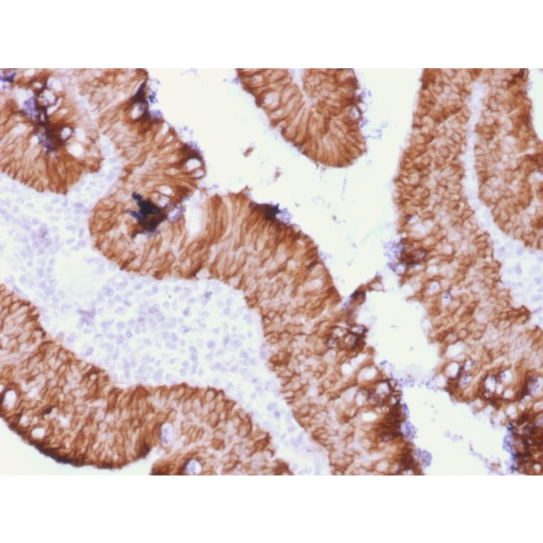 Immunohistochemistry - Anti-EpCAM Antibody [rEGP40/1372] (A249254) - Antibodies.com