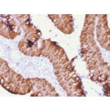 Immunohistochemistry - Anti-EpCAM Antibody [rEGP40/1372] (A249254) - Antibodies.com