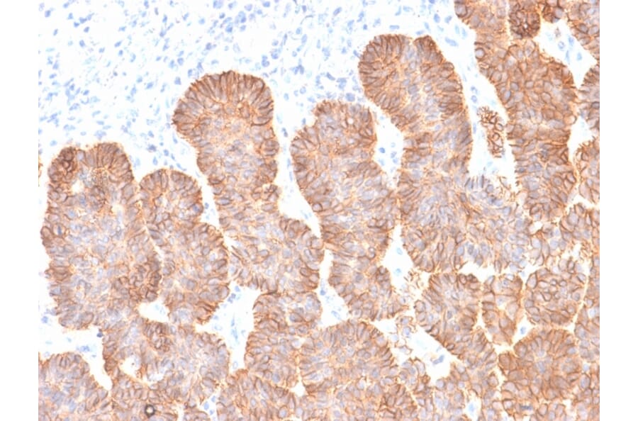 Immunohistochemistry - Anti-EpCAM Antibody [rEGP40/1372] (A249254) - Antibodies.com