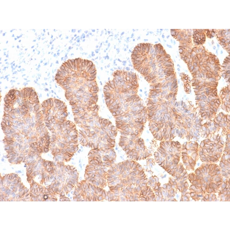 Immunohistochemistry - Anti-EpCAM Antibody [rEGP40/1372] (A249254) - Antibodies.com