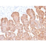 Immunohistochemistry - Anti-EpCAM Antibody [rEGP40/1372] (A249254) - Antibodies.com
