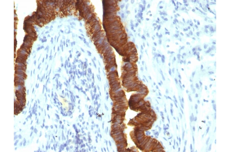 Immunohistochemistry - Anti-EpCAM Antibody [rEGP40/1110] (A249255) - Antibodies.com