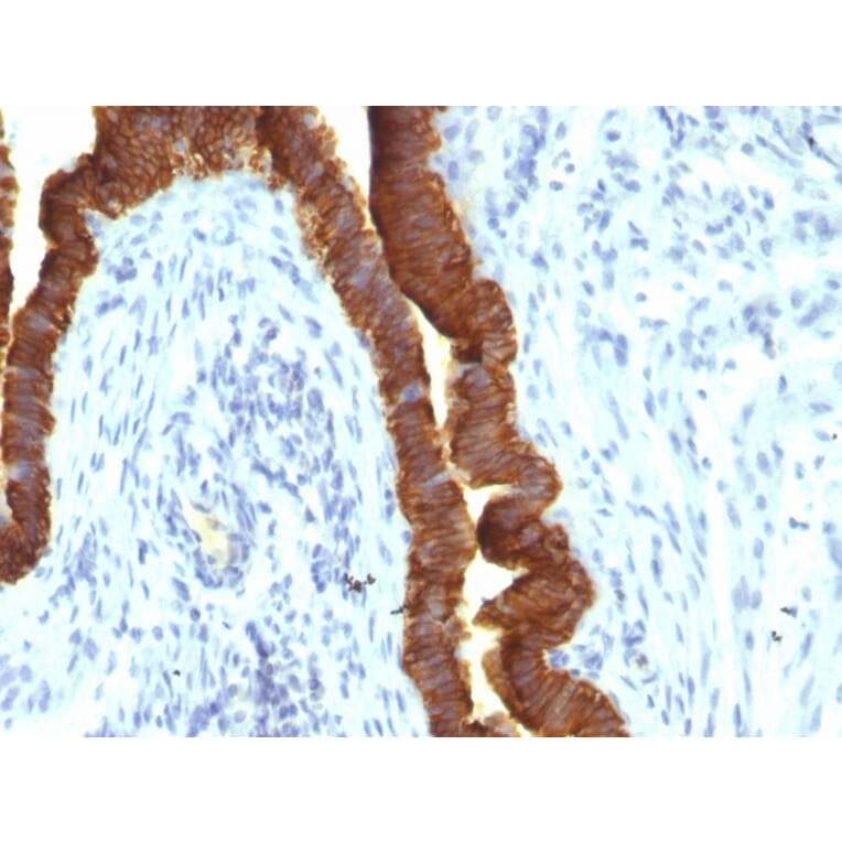 Immunohistochemistry - Anti-EpCAM Antibody [rEGP40/1110] (A249255) - Antibodies.com