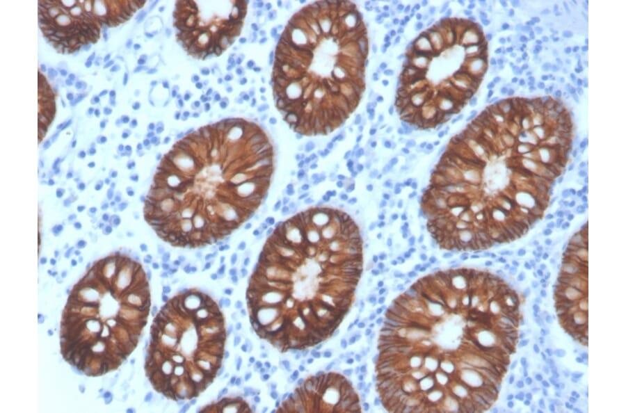 Immunohistochemistry - Anti-EpCAM Antibody [rEGP40/4547] (A249256) - Antibodies.com