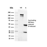 SDS-PAGE - Anti-EpCAM Antibody [rEGP40/4547] (A252434) - Antibodies.com