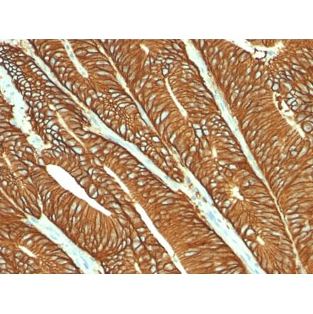 Immunohistochemistry - Anti-EpCAM Antibody [MOC-31] (A249256) - Antibodies.com