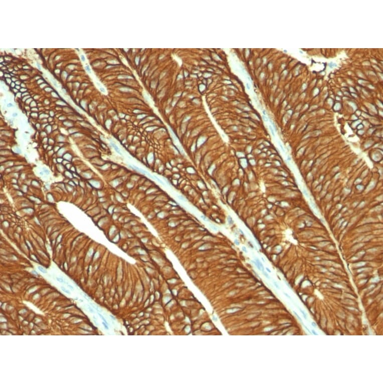 Immunohistochemistry - Anti-EpCAM Antibody [MOC-31] (A249256) - Antibodies.com