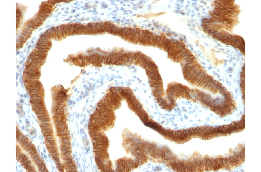 Immunohistochemistry - Anti-EpCAM Antibody [MOC-31] (A249257) - Antibodies.com