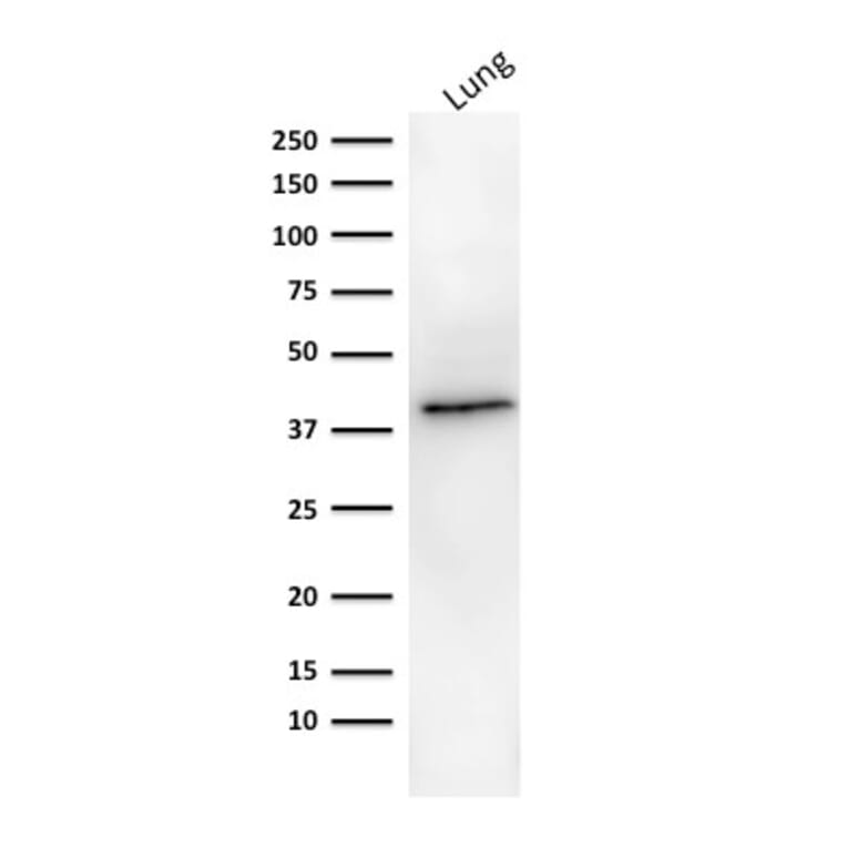 Western Blot - Anti-EpCAM Antibody [MOC-31] (A249257) - Antibodies.com