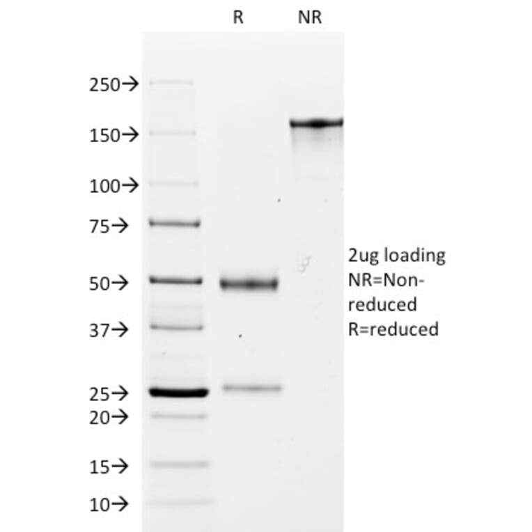 SDS-PAGE - Anti-EpCAM Antibody [MOC-31] (A249257) - Antibodies.com