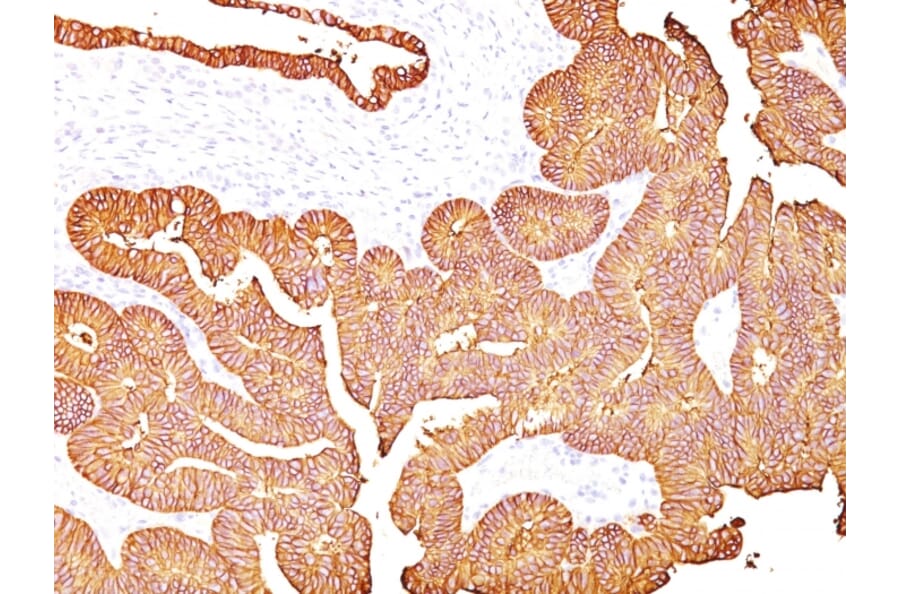 Immunohistochemistry - Anti-EpCAM Antibody [323/A3] (A249259) - Antibodies.com