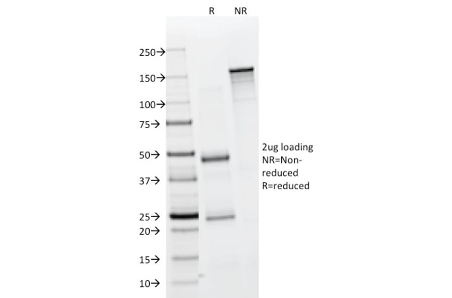 SDS-PAGE - Anti-EpCAM Antibody [323/A3] (A249259) - Antibodies.com