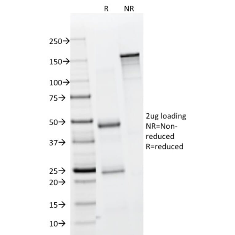 SDS-PAGE - Anti-EpCAM Antibody [323/A3] (A249259) - Antibodies.com