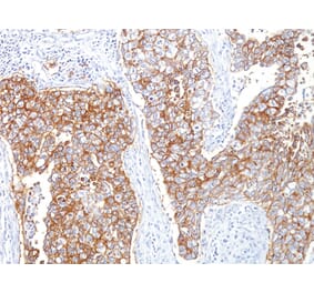 Immunohistochemistry - Anti-EpCAM Antibody [HEA125] (A249260) - Antibodies.com