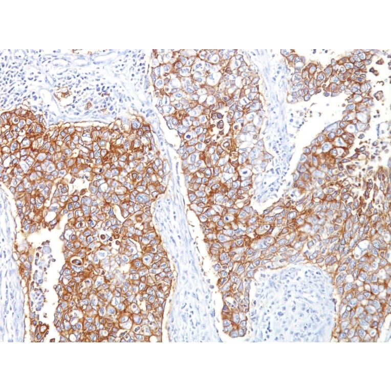 Immunohistochemistry - Anti-EpCAM Antibody [HEA125] (A249260) - Antibodies.com