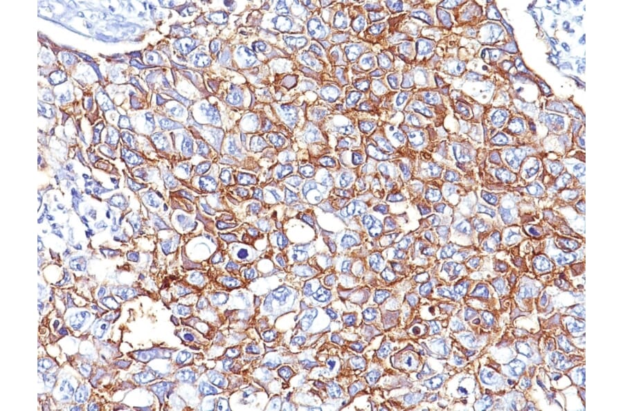 Immunohistochemistry - Anti-EpCAM Antibody [EGP40/826] (A249261) - Antibodies.com