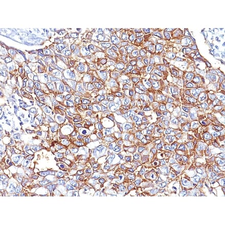 Immunohistochemistry - Anti-EpCAM Antibody [EGP40/826] (A249261) - Antibodies.com
