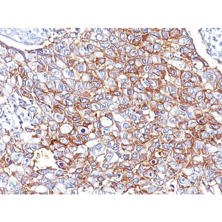 Immunohistochemistry - Anti-EpCAM Antibody [EGP40/826] (A249261) - Antibodies.com