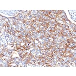 Immunohistochemistry - Anti-EpCAM Antibody [EGP40/826] (A249261) - Antibodies.com