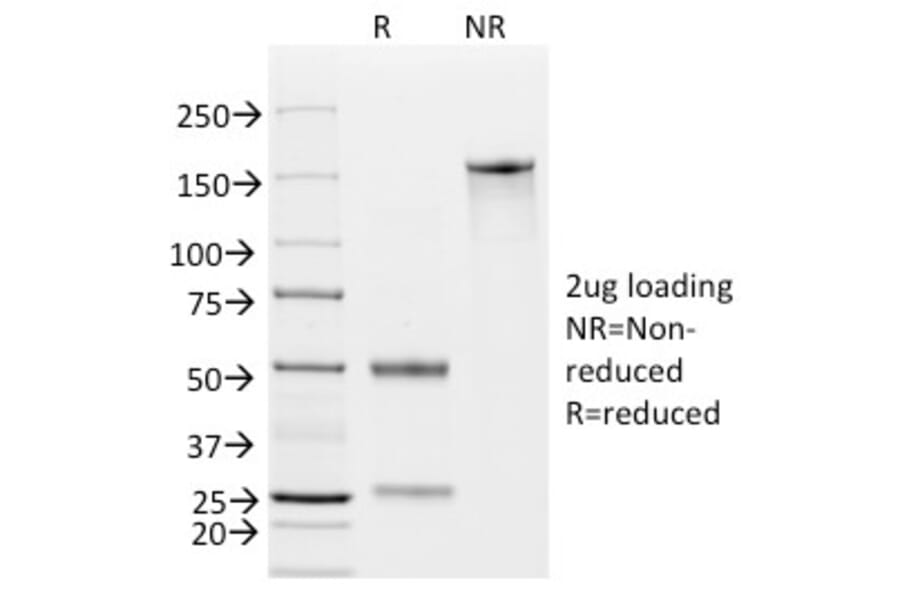 SDS-PAGE - Anti-EpCAM Antibody [EGP40/826] (A249261) - Antibodies.com