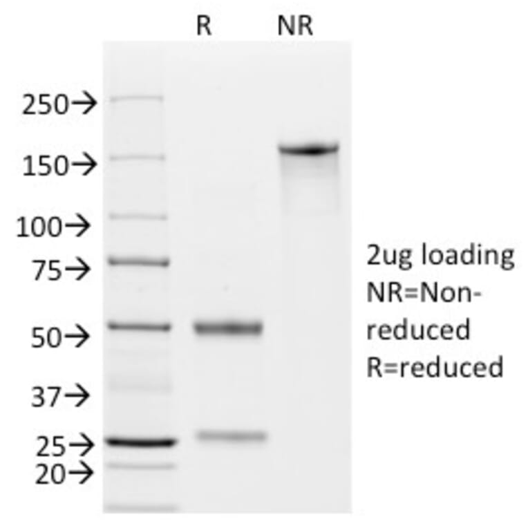 SDS-PAGE - Anti-EpCAM Antibody [EGP40/826] (A249261) - Antibodies.com