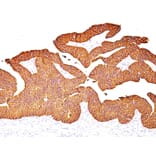 Immunohistochemistry - Anti-EpCAM Antibody [EGP40/837] (A249262) - Antibodies.com