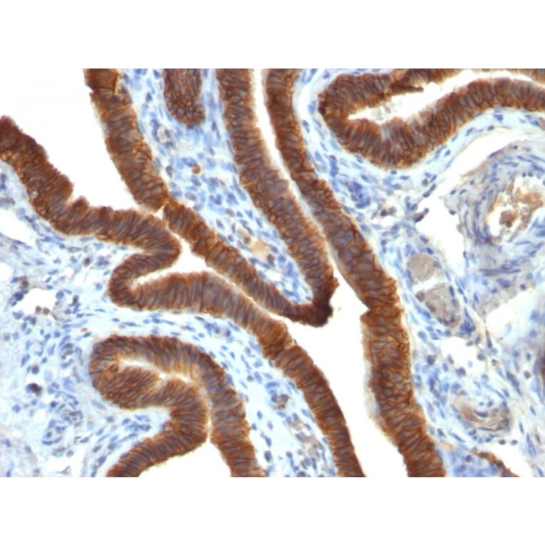 Immunohistochemistry - Anti-EpCAM Antibody [EGP40/837] (A249262) - Antibodies.com