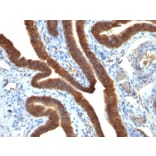 Immunohistochemistry - Anti-EpCAM Antibody [EGP40/837] (A249262) - Antibodies.com