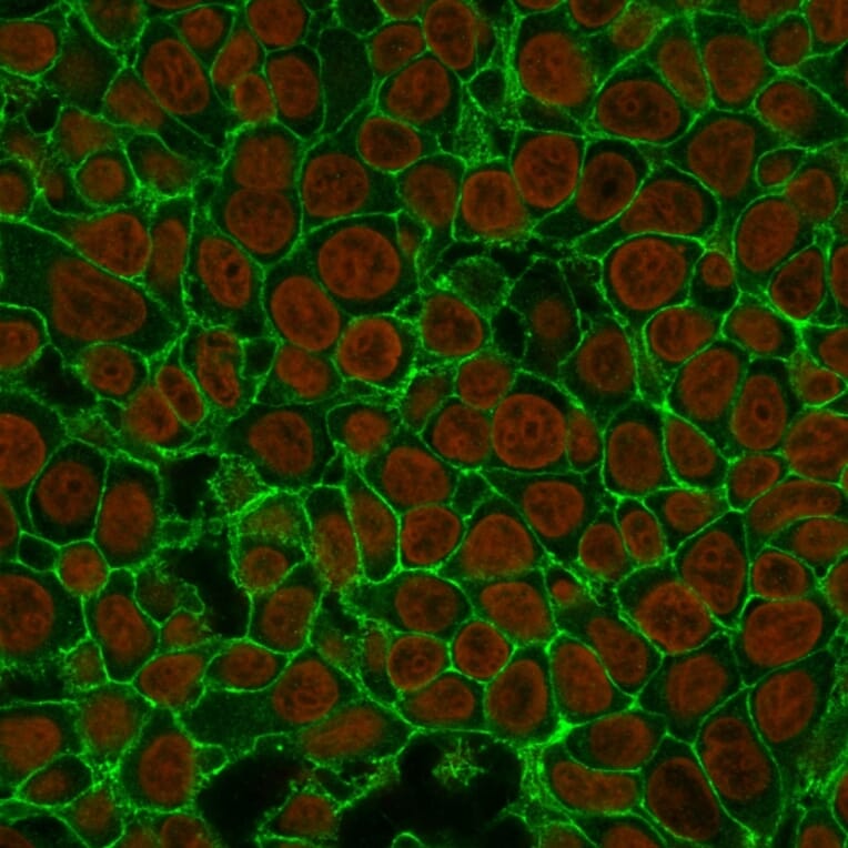 Immunofluorescence - Anti-EpCAM Antibody [EGP40/837] (A249262) - Antibodies.com