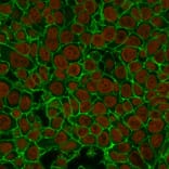 Immunofluorescence - Anti-EpCAM Antibody [EGP40/837] (A249262) - Antibodies.com