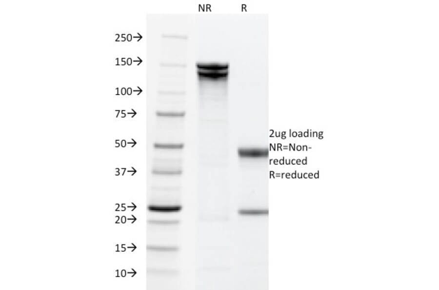 SDS-PAGE - Anti-EpCAM Antibody [PAN-EpCAM] (A249263) - Antibodies.com