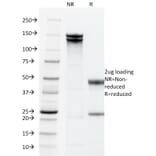 SDS-PAGE - Anti-EpCAM Antibody [PAN-EpCAM] (A249263) - Antibodies.com