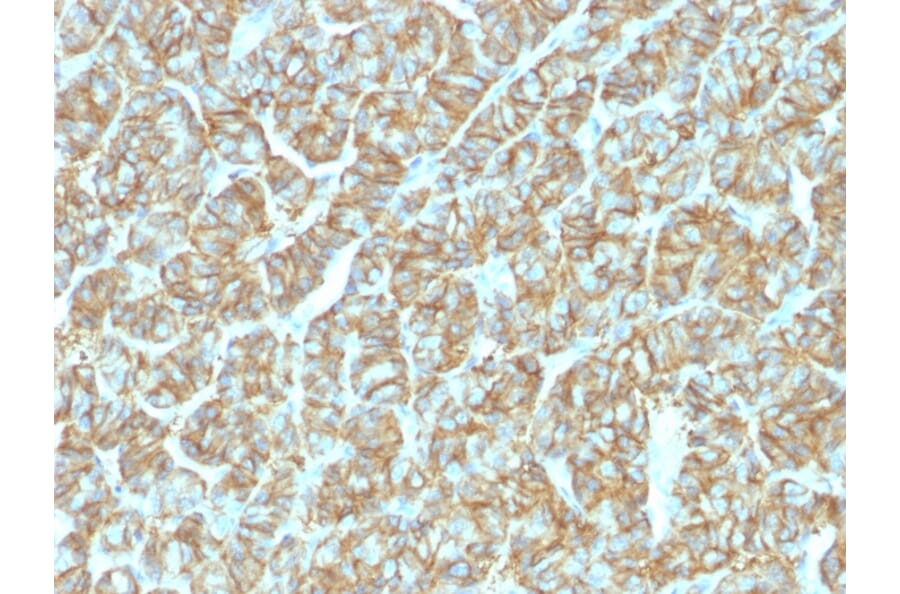 Immunohistochemistry - Anti-EpCAM Antibody [EGP40/1555R] (A252379) - Antibodies.com