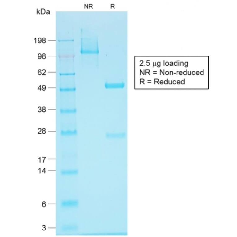 SDS-PAGE - Anti-EpCAM Antibody [EGP40/1555R] (A252428) - Antibodies.com